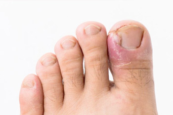 Podiatry Clinic Edgware - Chiropodist - Foot Doctor - Podiatry Station