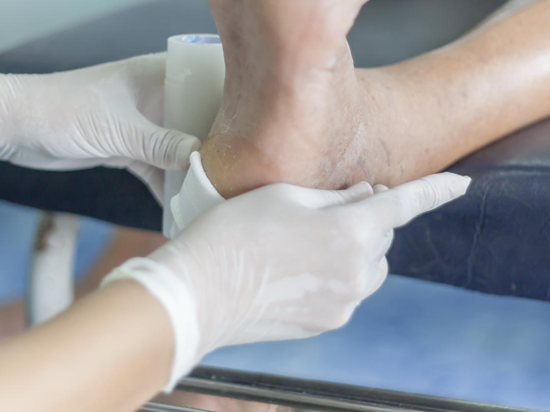 diabetic foot care