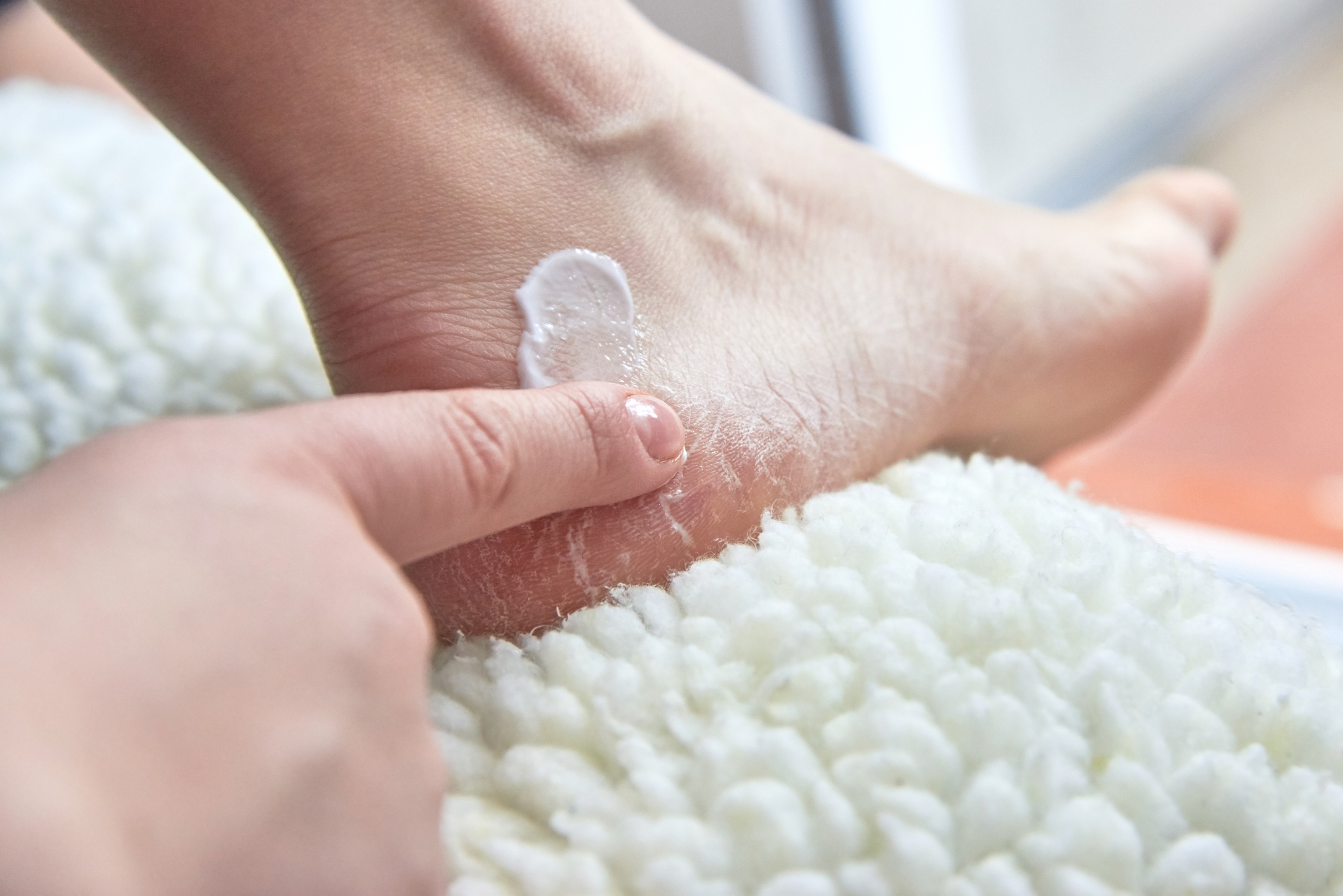 Dry Skin & Cracked Heels