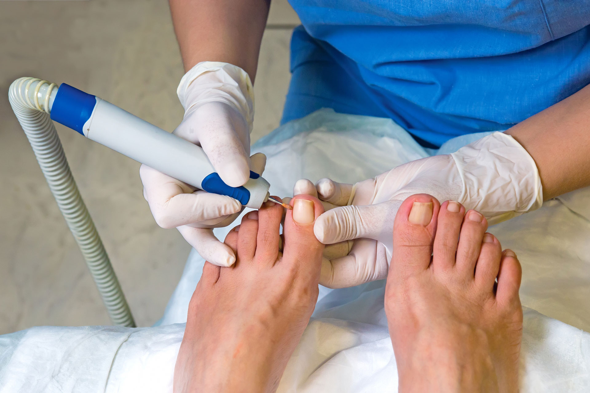 Podiatry treatment