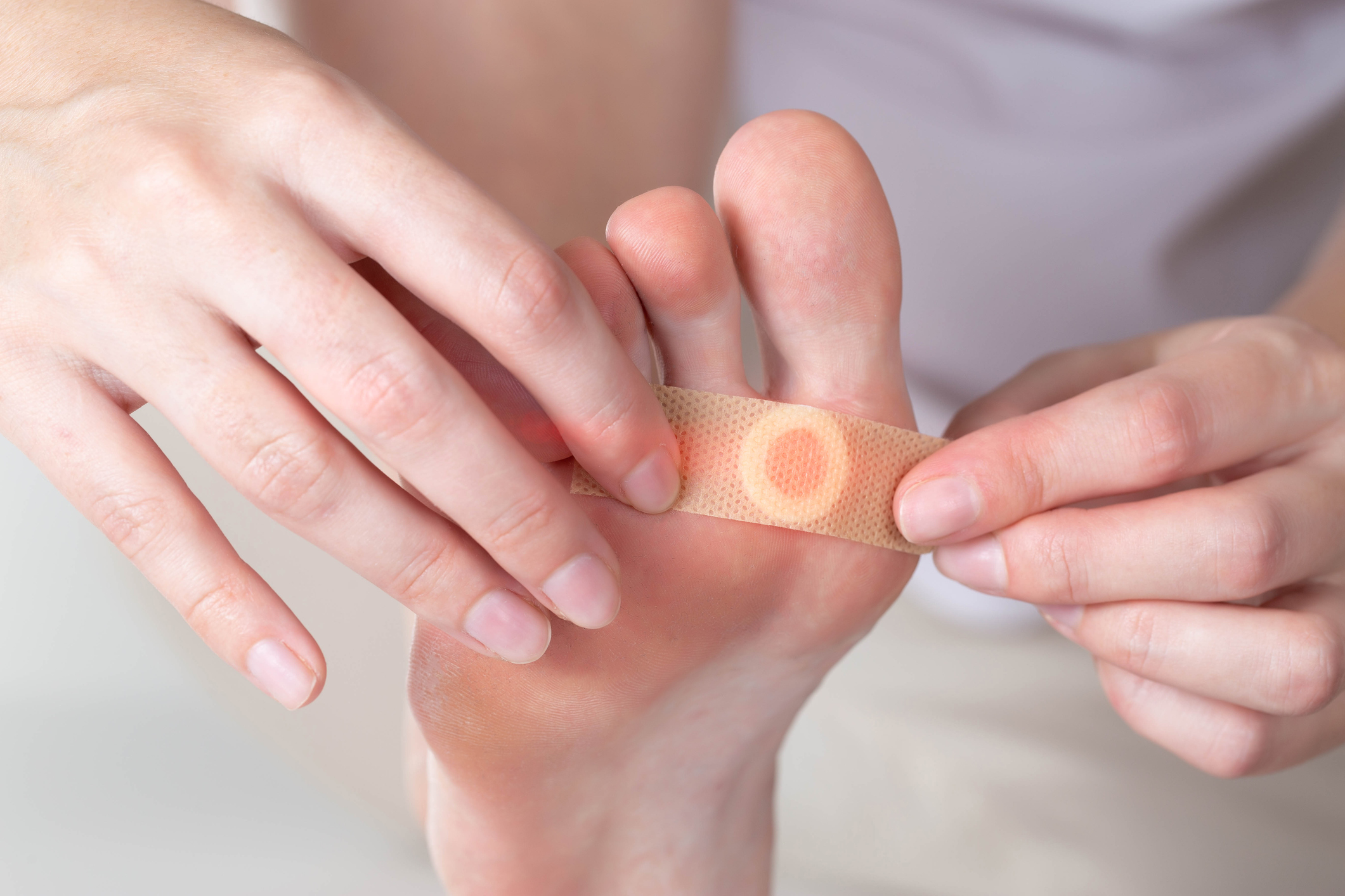 Corns & Calluses