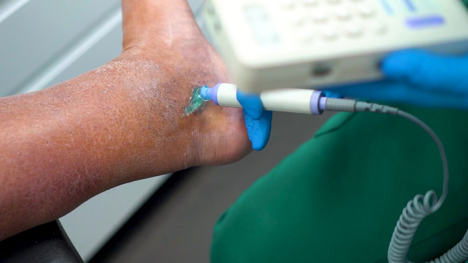 http://Diabetic%20foot%20care%20consultation