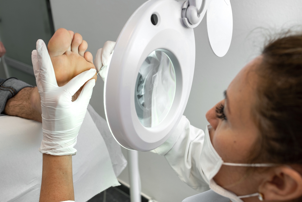 Dealing with Corns, Calluses and Cracked Heels: Causes and Care Tips