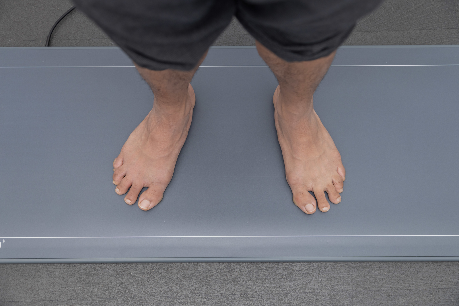 Morton’s Neuroma and Ball of Foot Pain: Diagnosis and Relief in Edgware