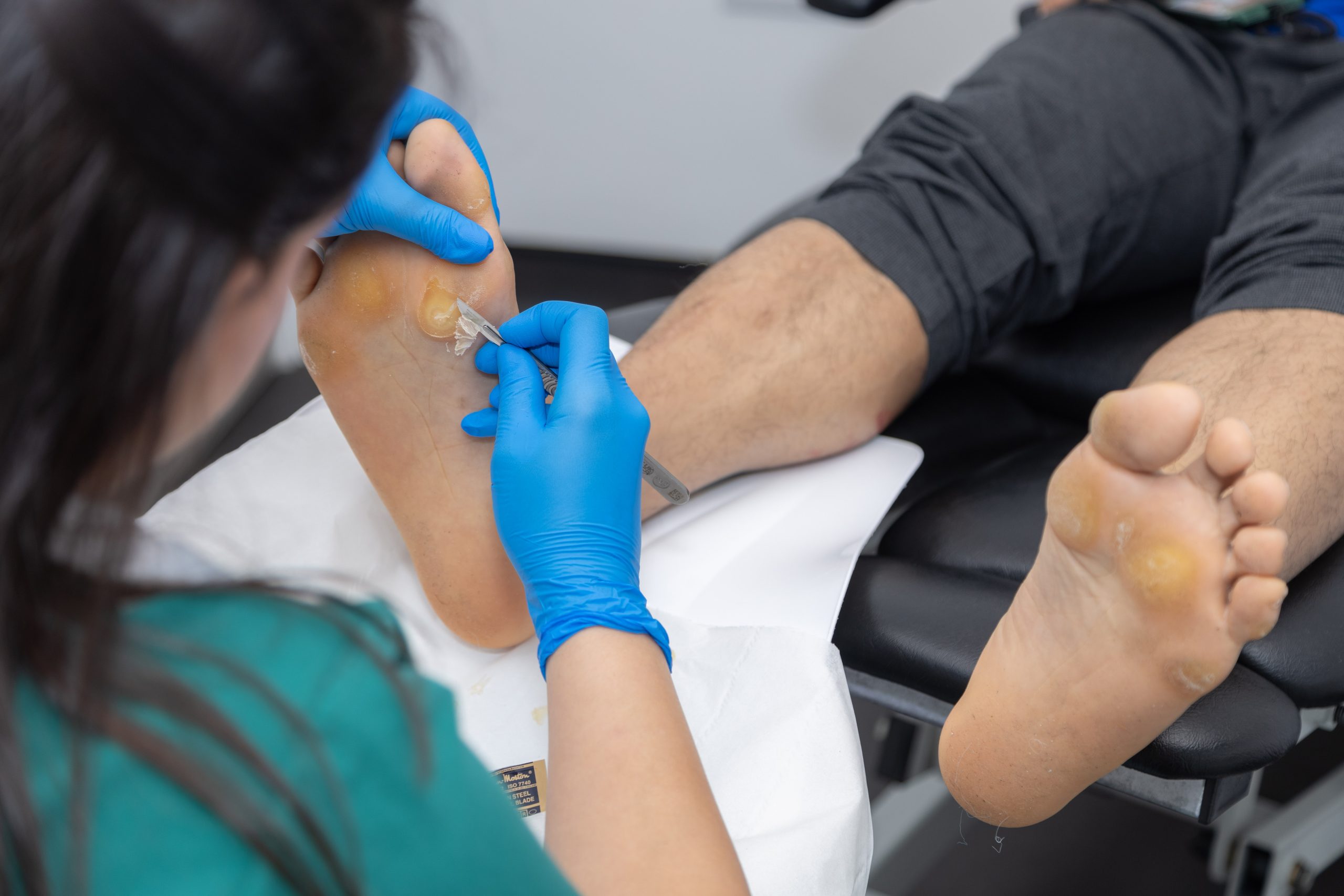 Medical Pedicures
