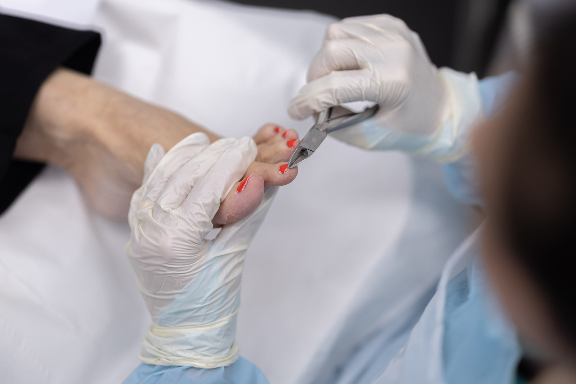 Medical Pedicures