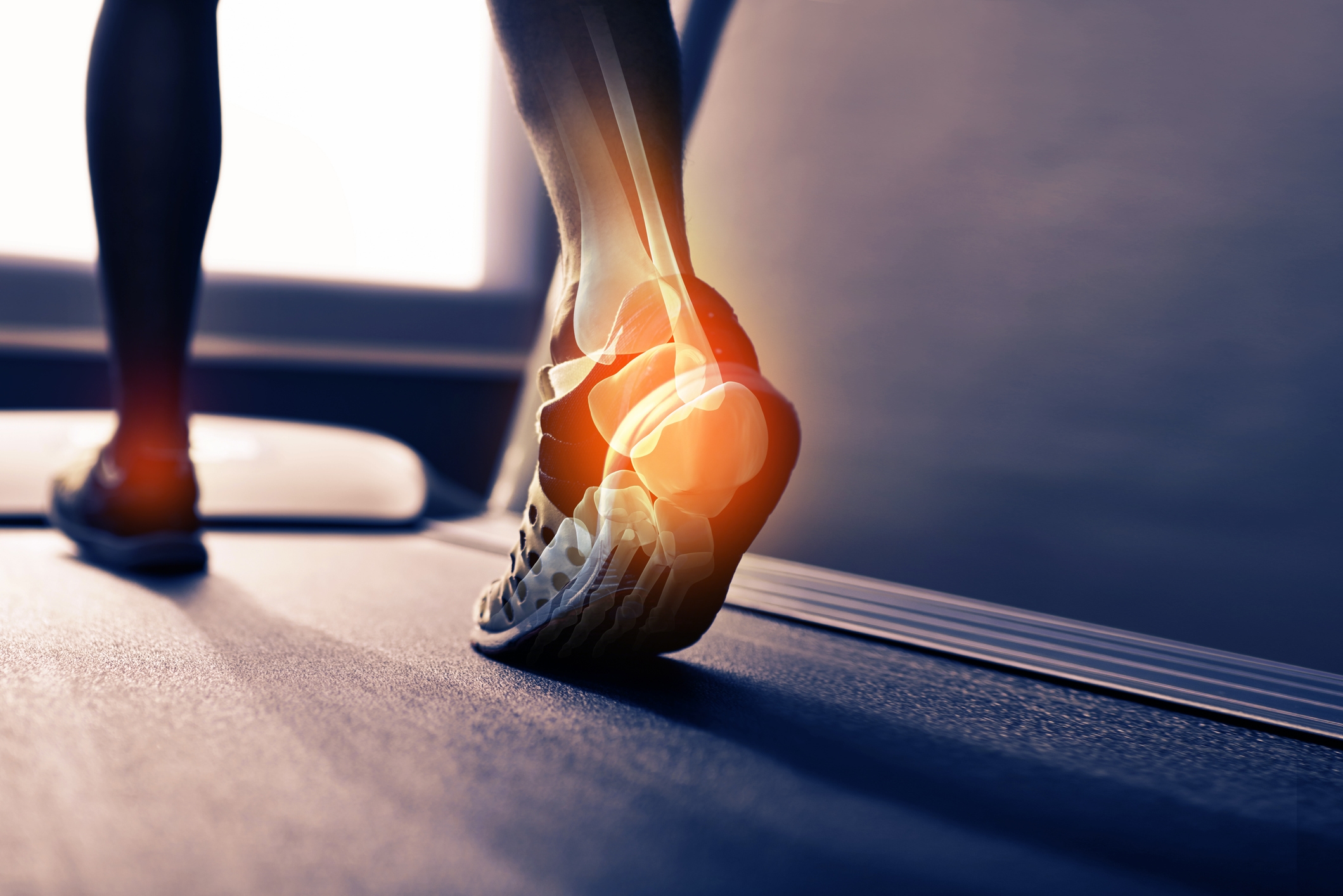 Bunion Pain & Heel Pain in Edgware: Plantar Fasciitis Treatment, Custom Orthotics & Corn Removal Solutions