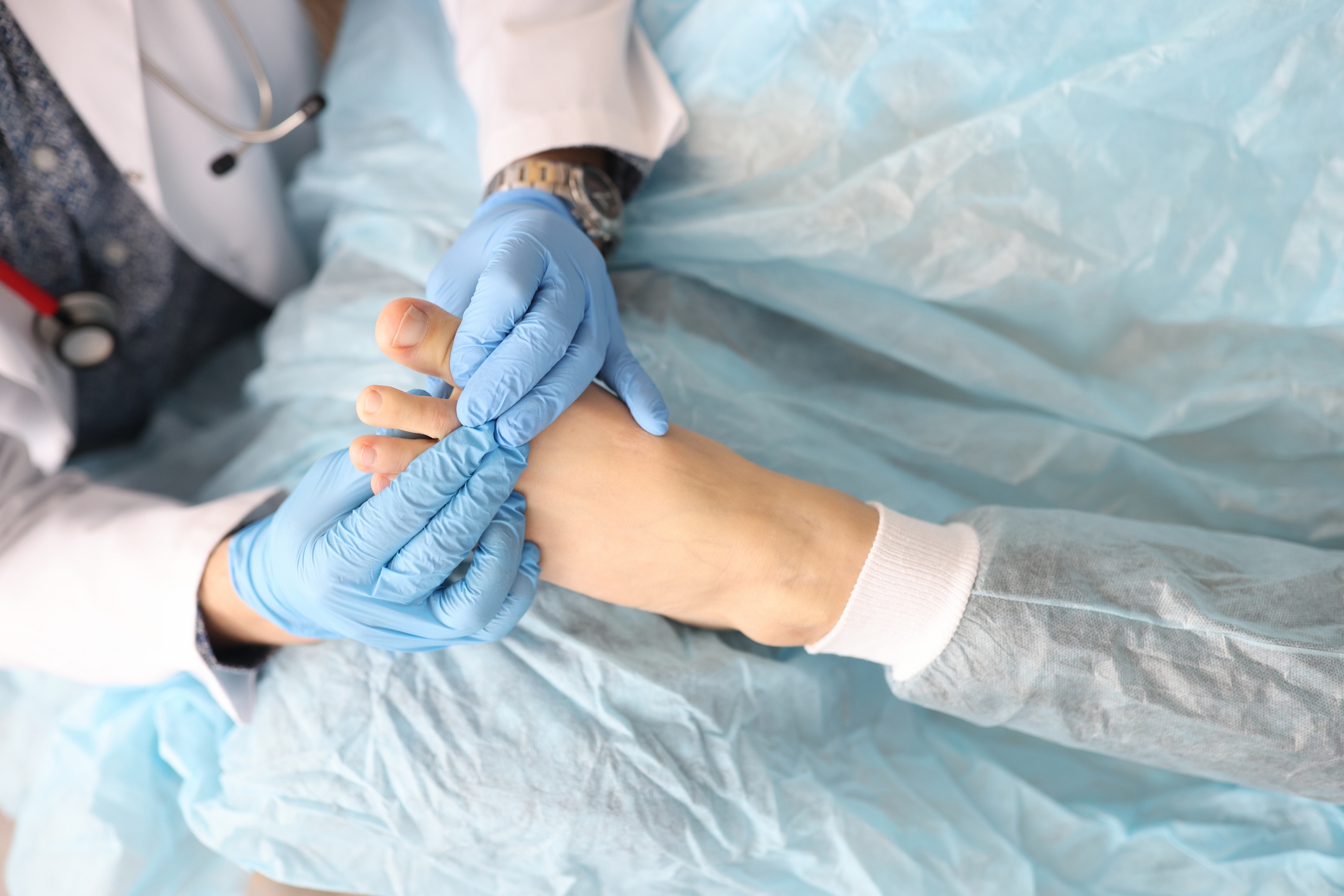 Fast Relief: Painless Ingrown Toenail Surgery in Edgware